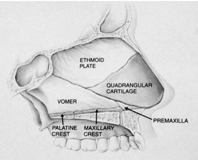 figura13