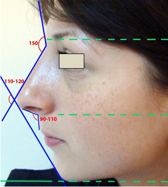 Figura 41. Unghiurile ideale nazo-faciale.