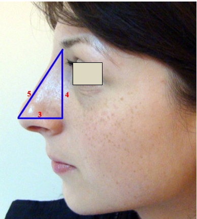Figura 18. Proiecţia nasului la nivelul feţei.