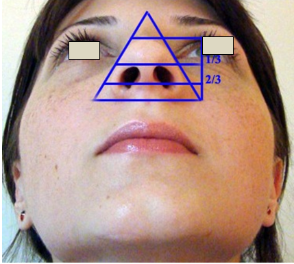 Figura 32. Baza nasului –Triunghi isoscel.