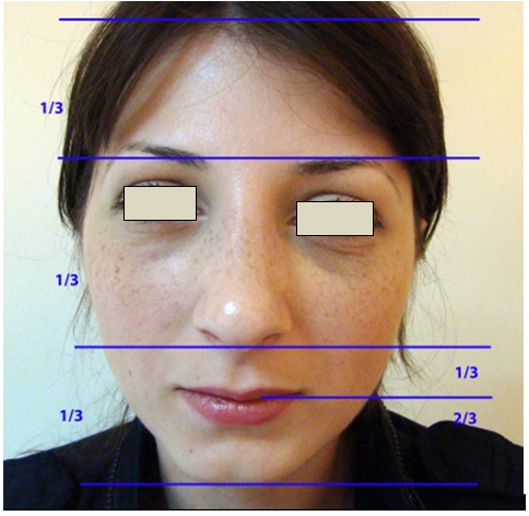 Figura 16. Zonele orizontale ale feţei.