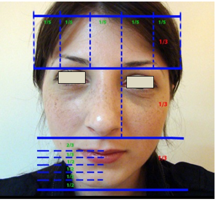 Figura 42. Zonele faciale.