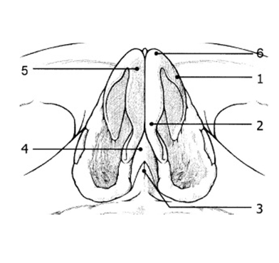 Figura 8. Scheletul piramidei nazale – vedere inferioară.     1. Ram lateral cartilaj alar;      2-5. Ram medial cartilaj alar;      3. Spina nazală anterioară;      4. Sept cartilaginos;      6. Domul cartilajului alar.
