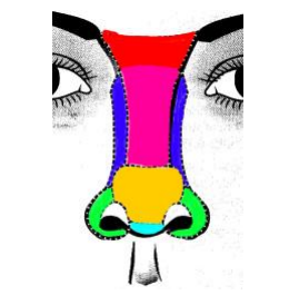 Figura 7. Subunitățile estetice ale nasului (modif. după Heppt).